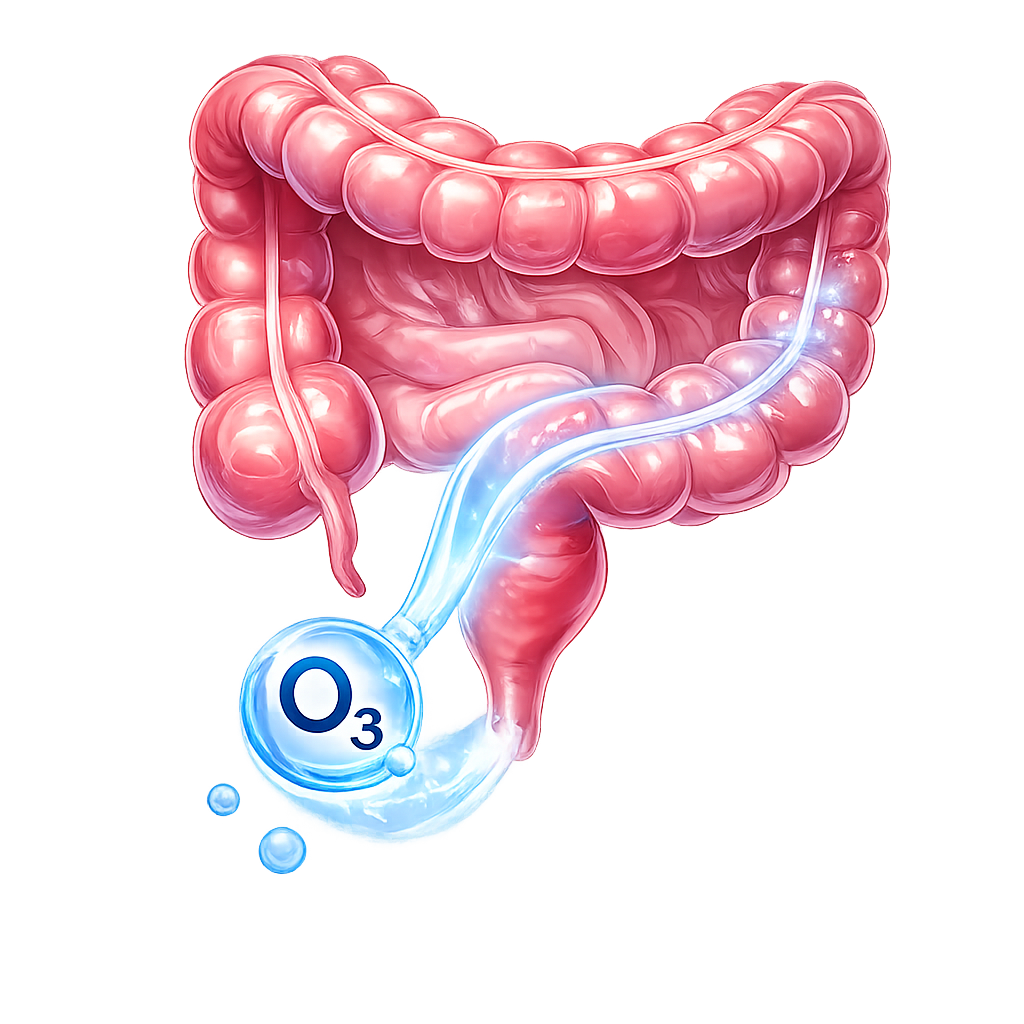 Rectal Ozone Insufflation